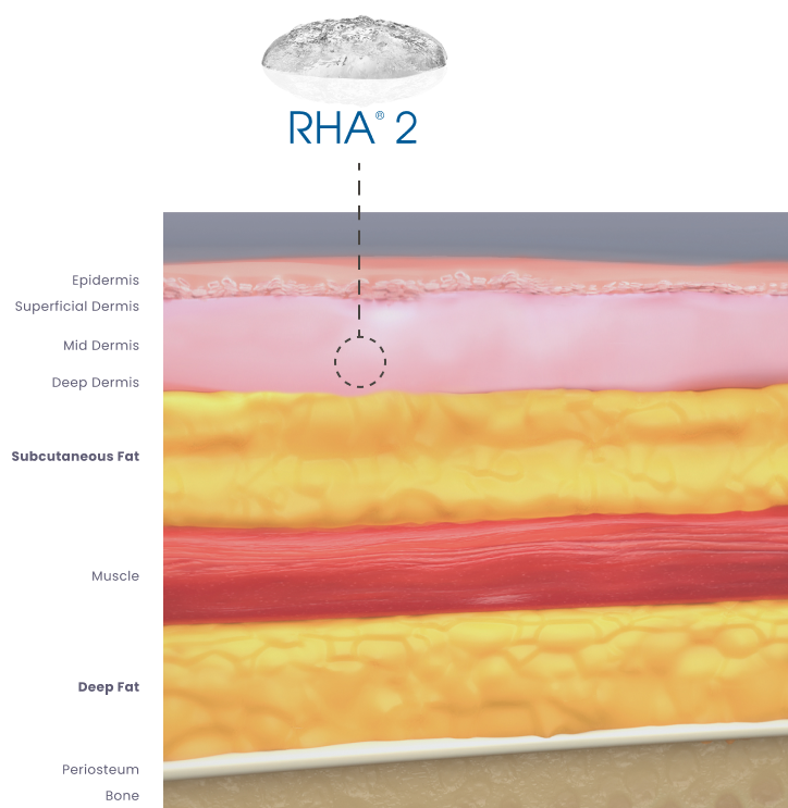 RHA Redensity Gel