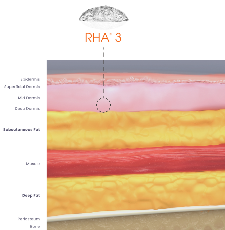 RHA Redensity Gel