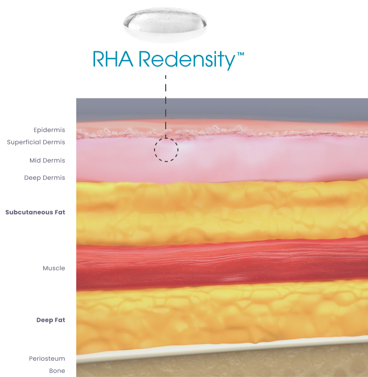 RHA Redensity Gel